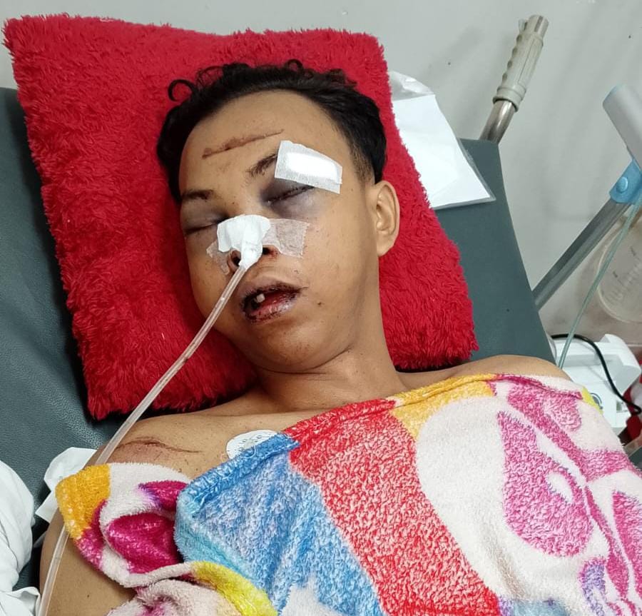 Kecelakaan di Depan Pabrik New Hope, Mobil Antre Bongkar di Bahu Jalan Diminta Ditertibkan 2836331