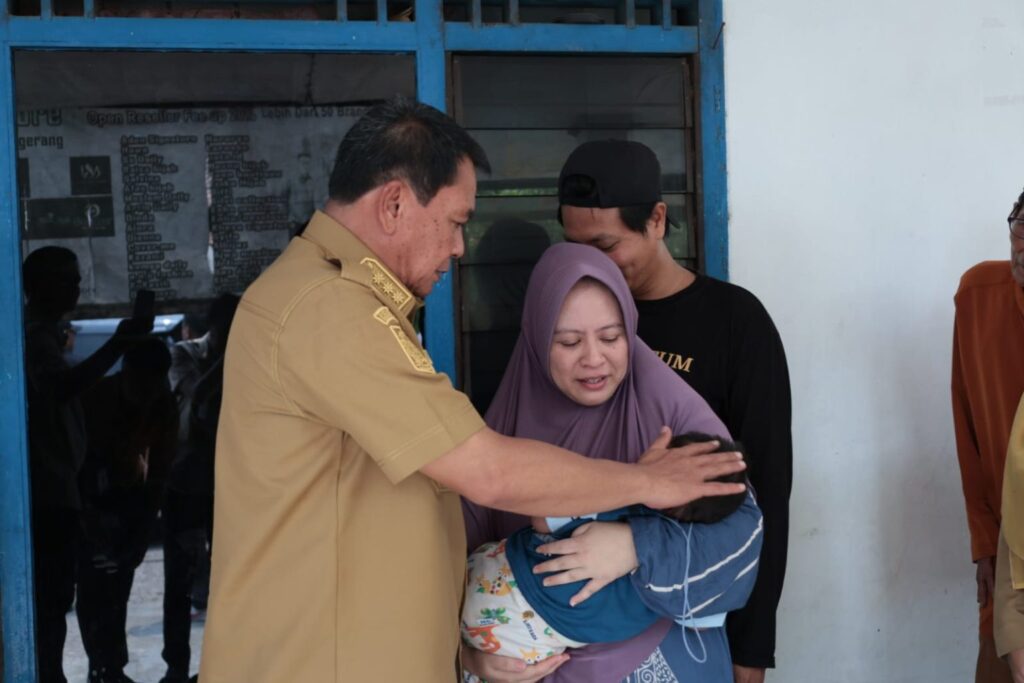 Bupati Tangerang Turun Tangan Bantu Bayi Penderita Jantung Bawaan di Cikupa, Pastikan Semua Biaya Medis Gratis 3242748